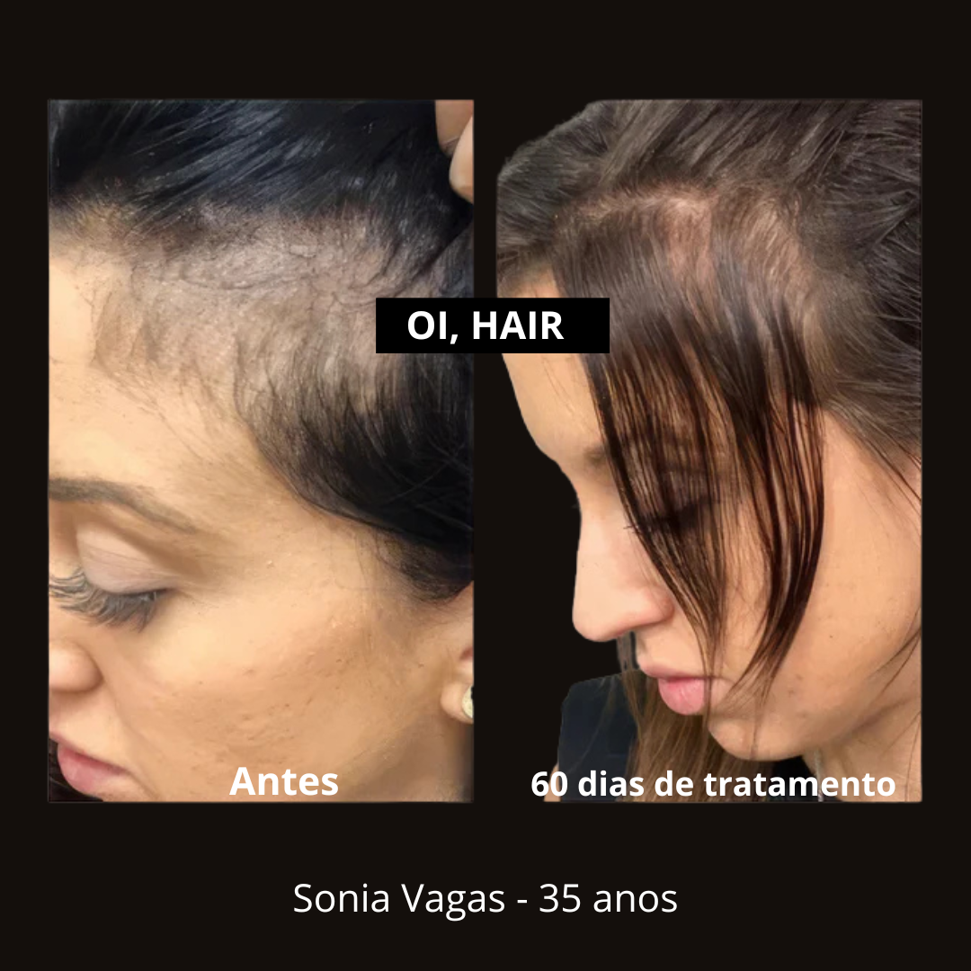 Oi, Hair! Tônico Capilar Anti Queda | 3 Unidades