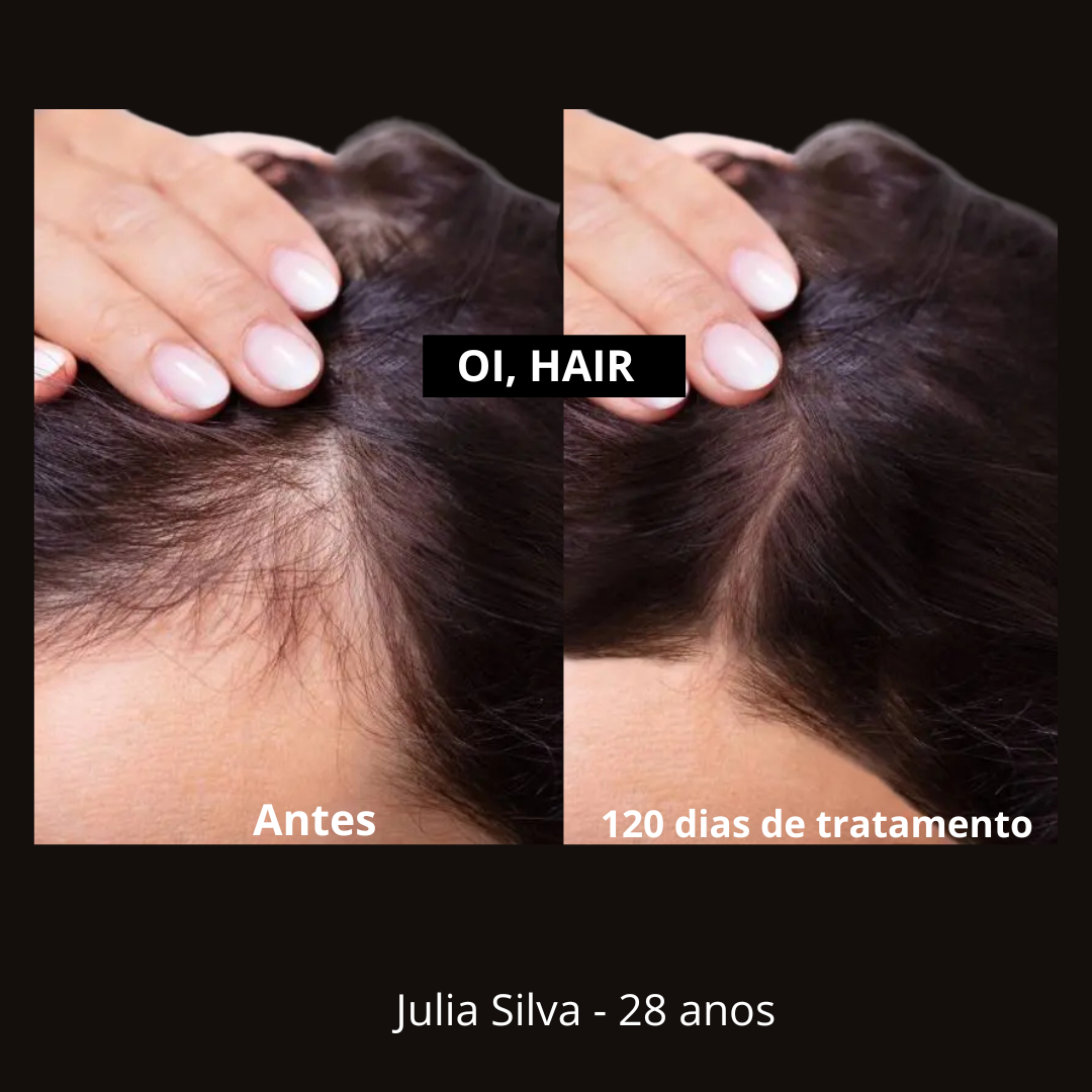 Oi, Hair! Tônico Capilar Anti Queda | 3 Unidades